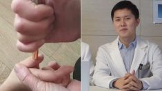 의사들도 체했을 때 손 따는지 직접 물어봤다 (영상)